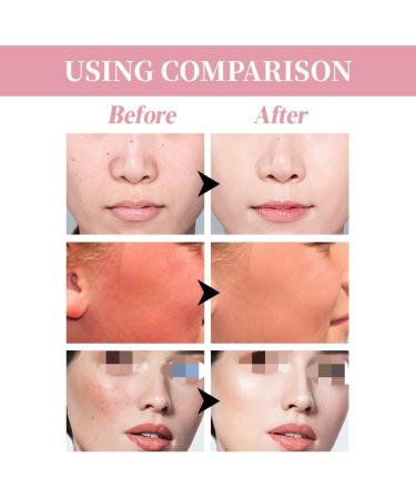 BENGOOD Protective Cream Moisturizer with UV Protection or even Skin Protective Cream - Buy Online on GoSupps.com