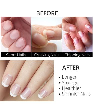Excuse Me Nail Hardener Advanced Formula Strengthener & Growth System, 0.5 oz (Pack of 2) - Buy Online on GoSupps.com