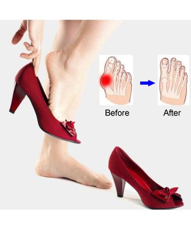 Lamkrtlp Gel Bunion Protector - 2 Pairs Big Toe Straightener & Guard for Foot Pain Relief - Buy Online on GoSupps.com