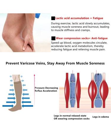 Zingso Compression Stockings for Men & Women - Best Medical Socks 20-25 mmHg for Running Travel Hiking & Circulation Care - Buy Online on GoSupps.com
