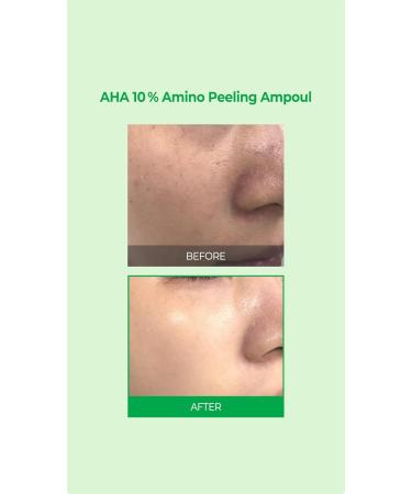 Buy SOME BY MI AHA 10% Amino Peeling Ampoule 30ml - Exfoliating Serum for Radiant Skin | International Shipping Available - Buy Online on GoSupps.com