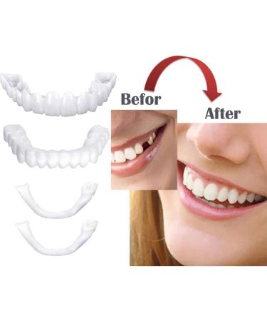 XLBHSH Temporary Deans - 3 Pairs of Instant Perfect Smile Teeth Veneers & Cosmetic Stickers | One Size Fits All - Comfort Fit Flex Ships Internationally - Buy Online on GoSupps.com