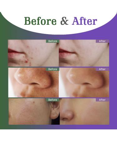 Waving Palms Green Tea Clay Stick Mask - Deep Cleansing Pores & Blackheads Purifying Facial Stick - Buy Online on GoSupps.com