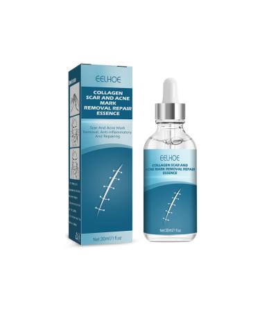Gentle Scar Removal Scar Repairing Diminishing Skin Scar Scar for All Skin Types 30ml (as Shown One Size) As Shown One Size