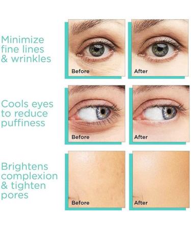 Ice Globes for Face & Eye Rejuvenation. Ice Therapy Cryo Roller Balls Ice Spoons Facial Treatment for Depuffing Toning Soothing & Headache Relief. - Buy Online on GoSupps.com