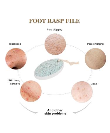 Natural Pumice Stone Set - 2 Pieces for Effective Pedicure & Dead Skin Removal | STON - Buy Online on GoSupps.com