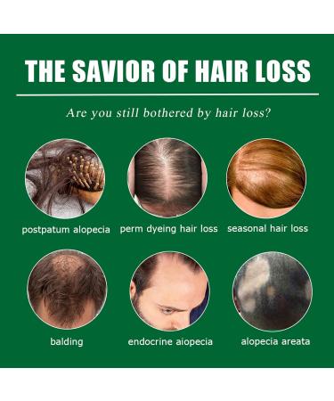 Ginger Anti Hair Loss Serum for Hair Regrowth - Men & Women - 3pcs 1 Fl Oz - Buy Online on GoSupps.com