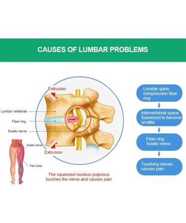 Premium Return Decompression Belts | Lumbar Support for Lower Back Pain Relief | Effective Back Traction Equipment (Color: SVA SVART) - Buy Online on GoSupps.com