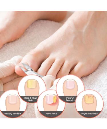 Thick Toenail Clipper Ingrown Toenail Trimmer Curved Strong Nail Cutter for Ingrown Toenail Treatment - Buy Online on GoSupps.com