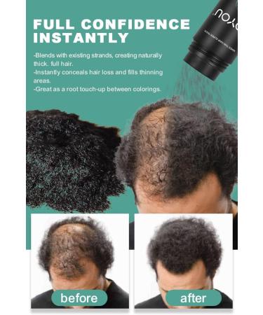 UOYOU GREY Hair Fibres 27.5g Bottle - Natural Keratin Hair Fibers Concealer for Thinning Hair - Men and Women | Hair Loss Solution - Grey Hair Building Fibres Powder (Pack of 1) - Buy Online on GoSupps.com