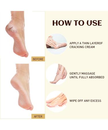 Anti-Crack Foot Creams Foot Creams Anti-Crack Heel Cream Natural Foot Soothing Cream Anti-Dryness Crack Cream Anti Freezing Dry Cracks And Cracks Heal Ointment - Buy Online on GoSupps.com