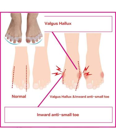 ENPAP Men's Toe Separator Socks - Gel Hammer Toe Corrector & Valgus Straightener - 1 Pair - Buy Online on GoSupps.com