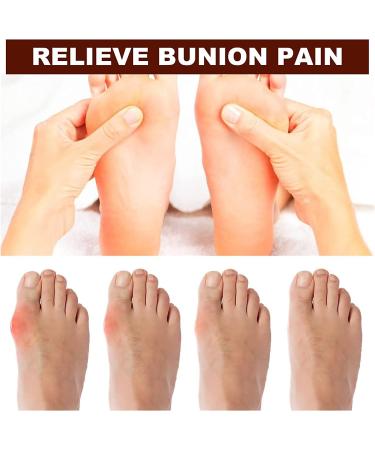 AAOCLO 2pcs Anti Bunion Treatment Oil Pain Relief Roller - Foot Care Corrector for Women & Men - Pro Health Solution - Buy Online on GoSupps.com