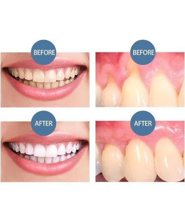 NQNFWCRJ Tooth Repair Gel Gum Repair Gel Gum Treatment Gel Gum Therapy Gel for Receding Gums - Buy Online on GoSupps.com