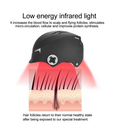 Premium Hair Growth Helmet - Alopecia Therapy with Advanced Technology for Hair Loss Prevention - Buy Online on GoSupps.com
