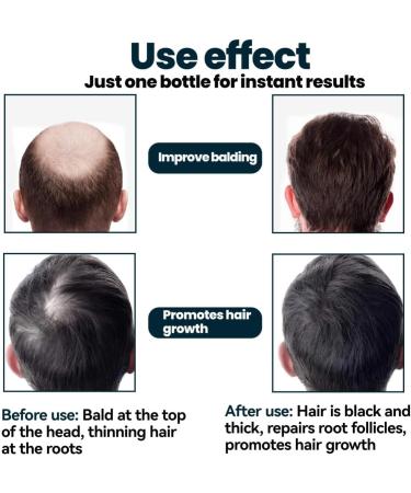 PAZRSASX Dense Hair Liquid for Men Hair Thickening and Nourishing Serum - Buy Online on GoSupps.com