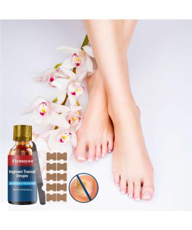 Ingrown Toenail Treatment Kit - Easy Home Relief for Men & Women | Ingrown Toenail Removal Solution - Buy Online on GoSupps.com