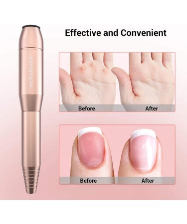 Melodysusia 11-in-1 Electric Nail File Set - Professional Gel Nail Cutter & Pedicure Kit for Nail Studios & DIY Manicures | Golden D-PROFI - Buy Online on GoSupps.com