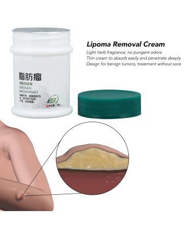 Lipoma Removal Cream 30g - Eliminate Fibroids and Cellulite, Improve Skin Elasticity - Lipomyoma Treatment and Exfoliating Beauty Cream - Buy Online on GoSupps.com