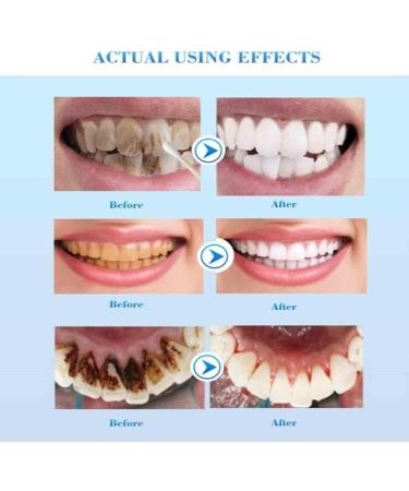 Yanjiayi Bamboo Charcoal Toothpaste - Brightening Activated Carbon Deep Clean | Fresh Breath & Stain Removal | 5-Pack - Buy Online on GoSupps.com