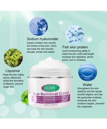 BeautyMALL Scar Removal Cream 50ml - Reduces Pimple Scars, Restores Skin to Original State - Softens and Smoothens Skin - Buy Online on GoSupps.com