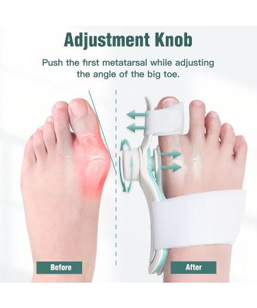Bunion Corrector for Women & Men - Orthopedic Toe Straightener & Splint for Hallux Valgus - Bunion Relief Brace with 3 Angle Fixing Plates - Buy Online on GoSupps.com