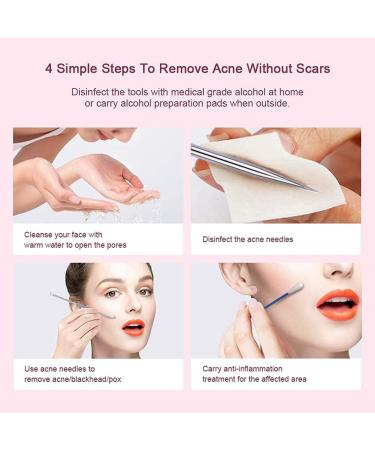 Blackhead Remover Comedone Squeezer Set Blackhead Remover Pore Cleanser Facial Cleansing Pimples Acne Whiteheads Blackhead Remover Kit with Box of 4 - Buy Online on GoSupps.com