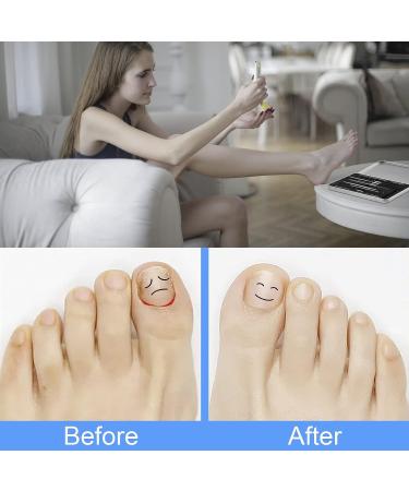 Ingrown Toenail Removal Kit - 10PCS Surgical Stainless Steel Tools for Nail Correction and Manicure Care - Buy Online on GoSupps.com