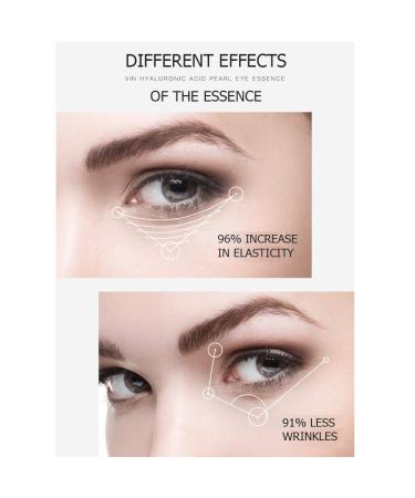 VENZEN Niacinome Moisturizing Eye Cream 20g - Anti-aging & Nourishing Formula for Smooth & Protected Skin - Buy Online on GoSupps.com