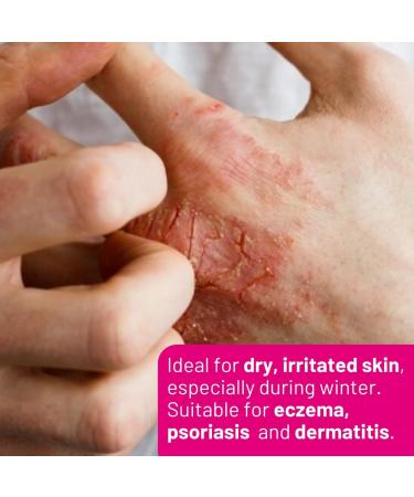 SkinRepairX Emollient Gel 100ml for Dry Skin Eczema Psoriasis Nappy Rash Dermatitis Vegan Fragrance Free Suitable from Birth - Buy Online on GoSupps.com