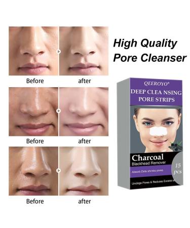 Beast's Nose Strips: 20PC Activated Carbon Blackhead Removal & Pore Cleansing Strips - Buy Online on GoSupps.com