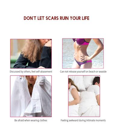 30g Scar Removal Cream for Acne Marks, Pimple, Blemishes, Stretch Marks, Burns - Treatment Ointment - Buy Online on GoSupps.com