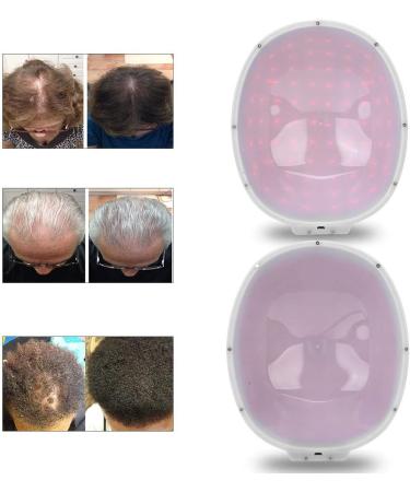 Hair Growth Helmet Device Anti Hair Loss Promote Hair Growth Hair Growth Helmet Beautymisc & Cap System Hair Growth For For Men And Women Device(Black-Uk) - Buy Online on GoSupps.com