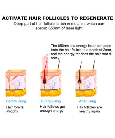 Hair Growth Helmet & Cap - 180 Light Chips for Thicker Fuller Hair | Effective Hair Loss Treatment & Therapy - Buy Online on GoSupps.com