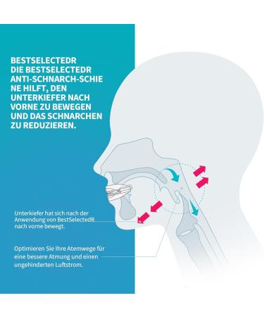 Effective Anti-Snoring Mouth Guard - Snore Stopper for Men & Women | International Shipping Available - Buy Online on GoSupps.com