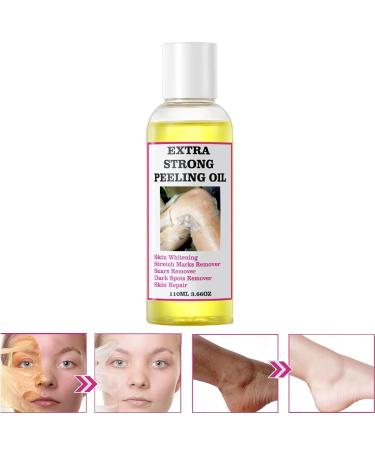 Extra Strong Yellow Peeling Oil | Exfoliating Solution for Body Hands Feet & Face | All Skin Types - 110ML - Buy Online on GoSupps.com