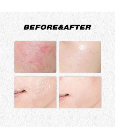 Ofanyia Beef Tallow for Skin Grass Fed Whipped Beef Tallow Cream Beef Tallow Moisturizer for Face & Body Tallow Balm for Skin Hydration - Buy Online on GoSupps.com