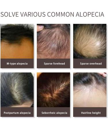  Yajimsa Multiflorum Nutrient Hair Essence - Hair Oil after shampoo with blend of natural vegetable oils for dry dull and damaged hair. Yajimsa - Buy Online on GoSupps.com