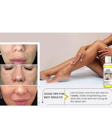Chemical Peel Oil for Face & Body Extra Strong Yellow Peeling Oil for Dark Skin Remover Chemical Exfoliant Peel Solution with Gentle Formula for All Skin Type - 3.88 FL.Oz/110 ML (2 PCS) - Buy Online on GoSupps.com