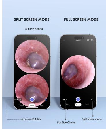 Anykit Wireless Otoscope Ear Camera - Dual View 3.9mm 720PHD WiFi Ear Scope with Ear Wax Removal Tool for Kids, Adults & Pets - Compatible with Android and iPhone - Buy Online on GoSupps.com