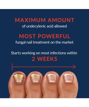 NAIL MAX Anti-Fungal Formula - USA Made Treatment for Finger and Toe Fungus - Maximum Strength Solution for Eliminating Infections - 0.5 fl oz - Buy Online on GoSupps.com