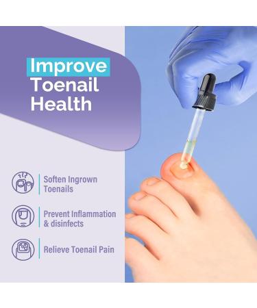 Ingrown Toenail Treatment & Pain Reliever - Softens for Easy Trimming | 30ml - Buy Online on GoSupps.com