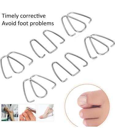 Ingrown Nail Corrector Relieve Pressure Ingrown Toenail Wire Fixer Professional Reshape for Pedicure Foot Care - Buy Online on GoSupps.com