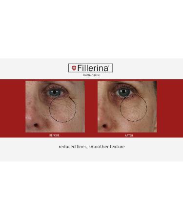 Fillerina 12 Densifying-Filler - Intensive Filler Treatment Grade 4 (2x30ml) - Buy Online on GoSupps.com