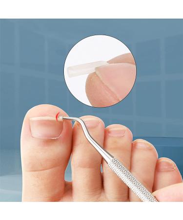 Ingrown Toenail Correction Treatment Kit - 30PCS Corrector Strips Brace Pedicure Tool Patch with 2PCS Lifter and File - Silver, 32pcs - Buy Online on GoSupps.com