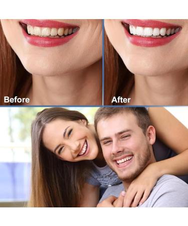 Jryxds Protheses Fake Teeth - Cosmetic Veneer Dentures for a Perfect Smile | International Shipping Available - Buy Online on GoSupps.com