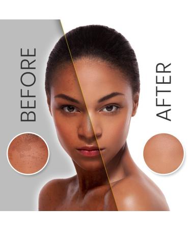 Makari Caviar Hydrating Face Cream (1 oz) - Nourishing, Hydrating, and Firming Formula for Sun-Damaged Skin | Fade Wrinkles, Spots, and Marks | Ideal for Dry, Normal, Aging, and Maturing Skin - Buy Online on GoSupps.com