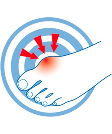 Epitact Hallux Valgus Protection - Size 36/38 | International Shipping Available - Buy Online on GoSupps.com