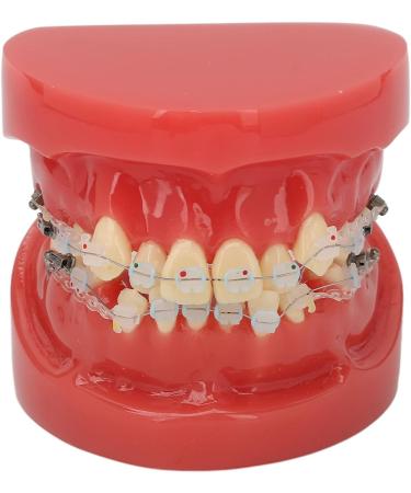 Orthodontic Model 24 Teeth with Metal Wire Case - Ideal for Dental Hospitals | International Shipping Available - Buy Online on GoSupps.com