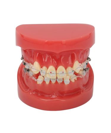 Orthodontic model made of ceramic orthodontic demonstration model made of ceramic 24 teeth - can clearly represent the orthodontic process